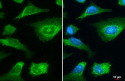 Invitrogen&trade;&nbsp;LIMCH1 Polyclonal Antibody
