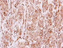Invitrogen MMP19 Polyclonal Antibody 100 &mu;L; Unconjugated:Antibodies,