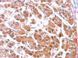 Invitrogen PUMA alpha Polyclonal Antibody 100 &mu;L; Unconjugated:Antibodies,