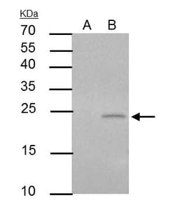 Invitrogen PUMA alpha Polyclonal Antibody 100 &mu;L; Unconjugated:Antibodies,