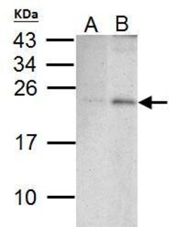 Invitrogen PUMA alpha Polyclonal Antibody 100 &mu;L; Unconjugated:Antibodies,