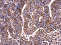 Invitrogen HSP60 Polyclonal Antibody 100 &mu;L; Unconjugated:Antibodies,