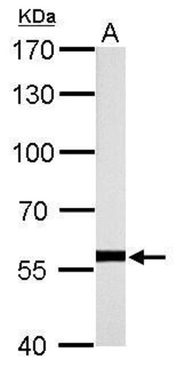 Invitrogen HSP60 Polyclonal Antibody 100 &mu;L; Unconjugated:Antibodies,