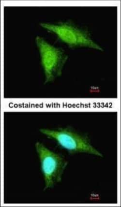 Invitrogen SMAD3 Polyclonal Antibody 100 μL; Unconjugated:Antibodies,