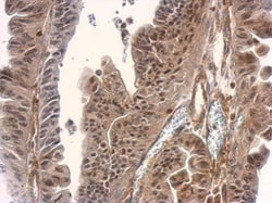 Invitrogen SMAD3 Polyclonal Antibody 100 μL; Unconjugated:Antibodies,