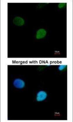 Invitrogen PRP19 Polyclonal Antibody 100 &mu;L | Buy Online | Invitrogen&trade; | Fisher Scientific