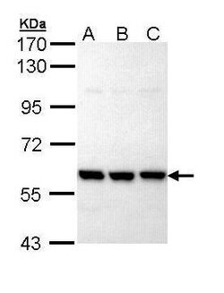 Invitrogen PRP19 Polyclonal Antibody 100 &mu;L | Buy Online | Invitrogen&trade; | Fisher Scientific