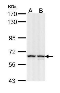Invitrogen PKM2 Polyclonal Antibody 100 &mu;L; Unconjugated:Antibodies,