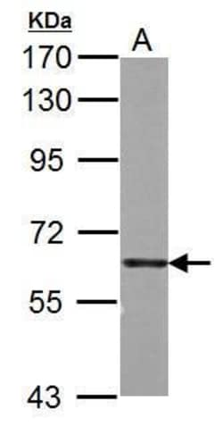 Invitrogen PKM2 Polyclonal Antibody 100 &mu;L; Unconjugated:Antibodies,