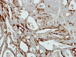 Invitrogen Collagen III Polyclonal Antibody 100 &mu;L; Unconjugated:Antibodies,