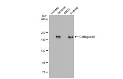 Invitrogen Collagen III Polyclonal Antibody 100 &mu;L; Unconjugated:Antibodies,