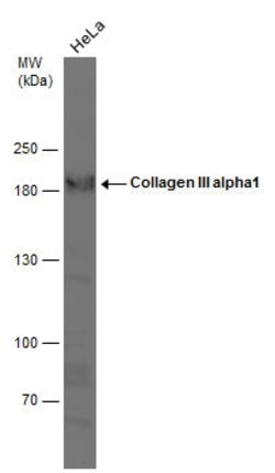 Invitrogen Collagen III Polyclonal Antibody 100 &mu;L; Unconjugated:Antibodies,