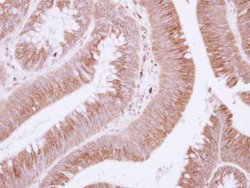 Invitrogen Fibulin 3 Polyclonal Antibody 100 &mu;L; Unconjugated:Antibodies,