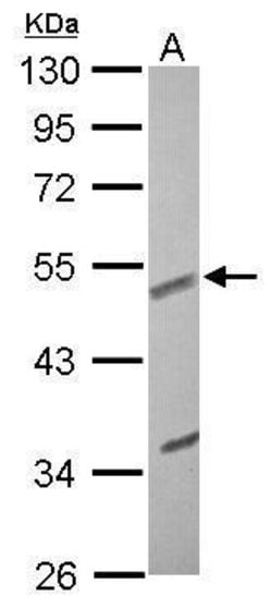 Invitrogen Fibulin 3 Polyclonal Antibody 100 &mu;L; Unconjugated:Antibodies,