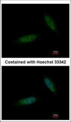 Invitrogen TBCK Polyclonal Antibody 100 μL; Unconjugated:Antibodies,