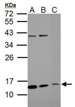 Invitrogen ROPN1B Polyclonal Antibody 100 &mu;L; Unconjugated:Antibodies,