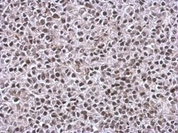 Invitrogen TIP60 Polyclonal Antibody 100 &mu;L; Unconjugated:Antibodies,