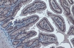 Invitrogen TIP60 Polyclonal Antibody 100 &mu;L; Unconjugated:Antibodies,
