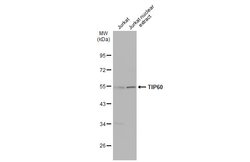 Invitrogen TIP60 Polyclonal Antibody 100 &mu;L; Unconjugated:Antibodies,