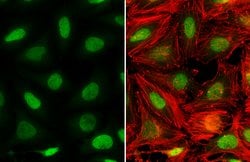 Invitrogen NAB1 Polyclonal Antibody 100 &mu;L; Unconjugated:Antibodies,