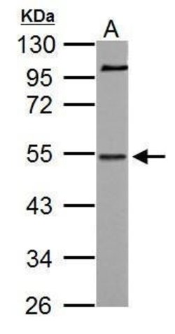 Invitrogen NAB1 Polyclonal Antibody 100 &mu;L; Unconjugated:Antibodies,