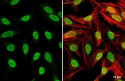 Invitrogen PARP1 Polyclonal Antibody 100 &mu;L; Unconjugated:Antibodies,