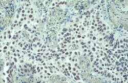 Invitrogen PARP1 Polyclonal Antibody 100 &mu;L; Unconjugated:Antibodies,