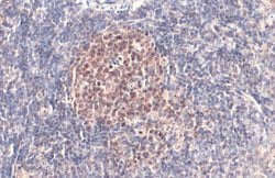 Invitrogen PARP1 Polyclonal Antibody 100 &mu;L; Unconjugated:Antibodies,
