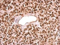 Invitrogen PARP1 Polyclonal Antibody 100 &mu;L; Unconjugated:Antibodies,