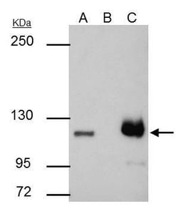Invitrogen PARP1 Polyclonal Antibody 100 &mu;L; Unconjugated:Antibodies,