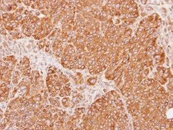 Invitrogen Calnexin Polyclonal Antibody 100 &mu;L; Unconjugated:Antibodies,