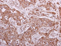 Invitrogen Calnexin Polyclonal Antibody 100 &mu;L; Unconjugated:Antibodies,