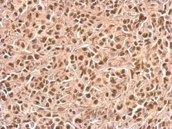 Invitrogen p21 Polyclonal Antibody 100 &mu;L; Unconjugated:Antibodies,