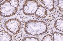 Invitrogen p21 Polyclonal Antibody 100 &mu;L; Unconjugated:Antibodies,