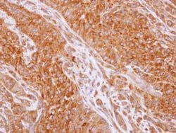 Invitrogen RIP2 Polyclonal Antibody 100 &mu;L | Buy Online | Invitrogen&trade; | Fisher Scientific