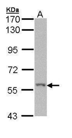 Invitrogen RIP2 Polyclonal Antibody 100 &mu;L | Buy Online | Invitrogen&trade; | Fisher Scientific