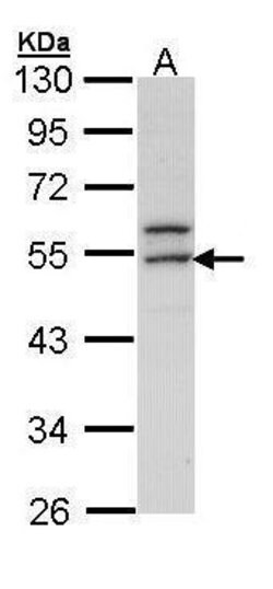Invitrogen ERG Polyclonal Antibody 100 μL; Unconjugated:Antibodies,