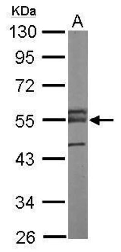 Invitrogen ERG Polyclonal Antibody 100 μL; Unconjugated:Antibodies,
