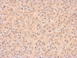 Invitrogen COX1 Polyclonal Antibody 100 &mu;L | Buy Online | Invitrogen&trade; | Fisher Scientific