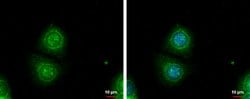 Invitrogen Galectin 3 Polyclonal Antibody 100 &mu;L; Unconjugated:Antibodies,