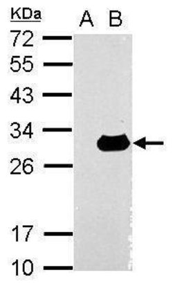 Invitrogen Galectin 3 Polyclonal Antibody 100 &mu;L; Unconjugated:Antibodies,