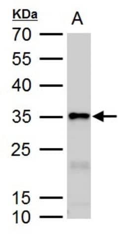 Invitrogen Galectin 3 Polyclonal Antibody 100 &mu;L; Unconjugated:Antibodies,