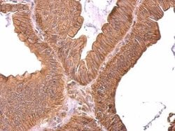 Invitrogen ROBO1 Polyclonal Antibody 100 &mu;L; Unconjugated:Antibodies,