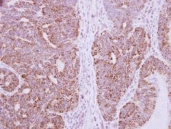 Invitrogen DcR3 Polyclonal Antibody 100 &mu;L; Unconjugated:Antibodies,