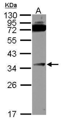 Invitrogen DcR3 Polyclonal Antibody 100 &mu;L; Unconjugated:Antibodies,