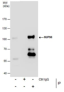 Invitrogen NUP98 Polyclonal Antibody 100 &mu;L | Buy Online | Invitrogen&trade; | Fisher Scientific
