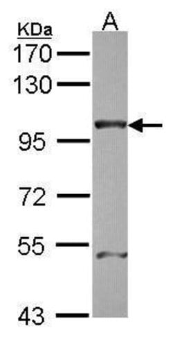 Invitrogen NUP98 Polyclonal Antibody 100 &mu;L | Buy Online | Invitrogen&trade; | Fisher Scientific