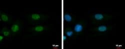 Invitrogen ADARB1 Polyclonal Antibody 100 &mu;L; Unconjugated:Antibodies,