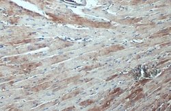 Invitrogen ASAH1 Polyclonal Antibody 100 &mu;L; Unconjugated:Antibodies,