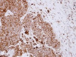 Invitrogen ASAH1 Polyclonal Antibody 100 &mu;L; Unconjugated:Antibodies,